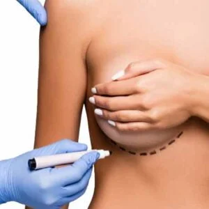 Doctor drawing marks on female breast before cosmetic surgery operation