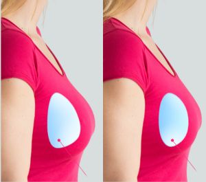 menu Round vs teardrop shape breast implants