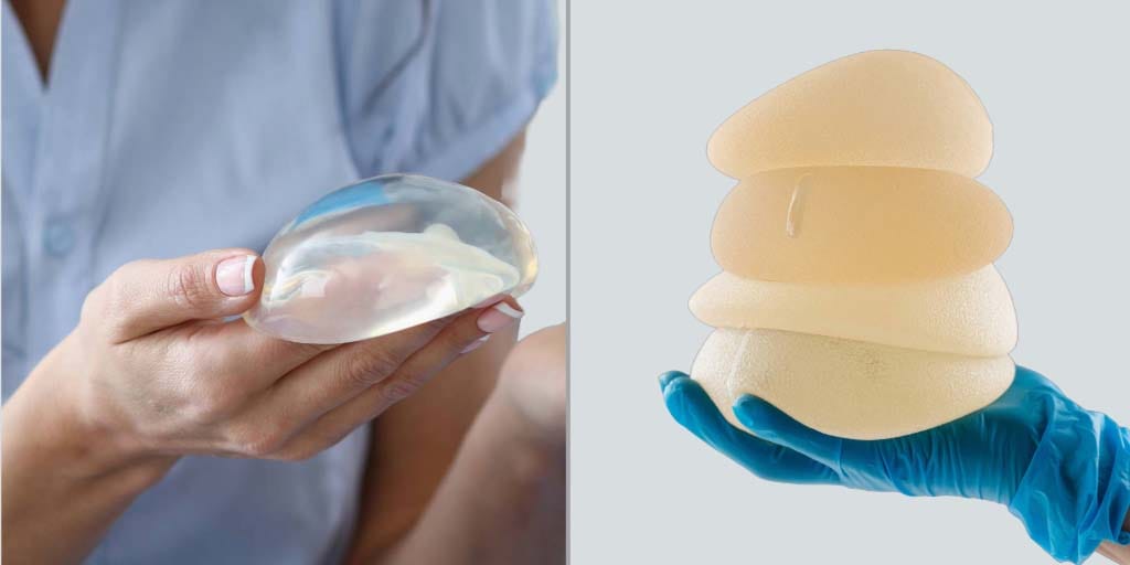 Breast implants comparison: smooth versus textured surface types